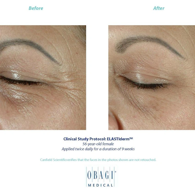 Obagi Obagi ELASTIderm Eye Serum - Product View 4